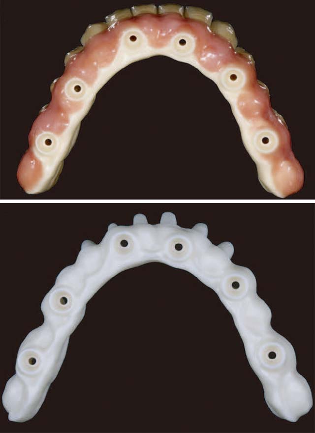 ホワイトブリッジ