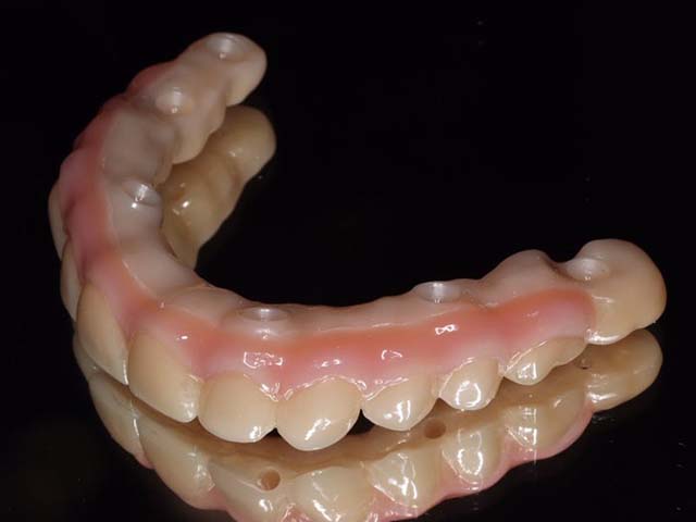 スペシャルブリッジ