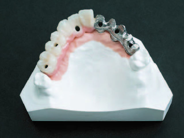 スタンダードブリッジ