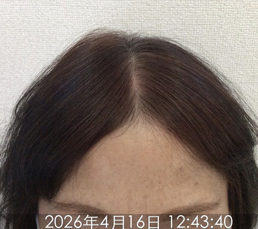 施術後