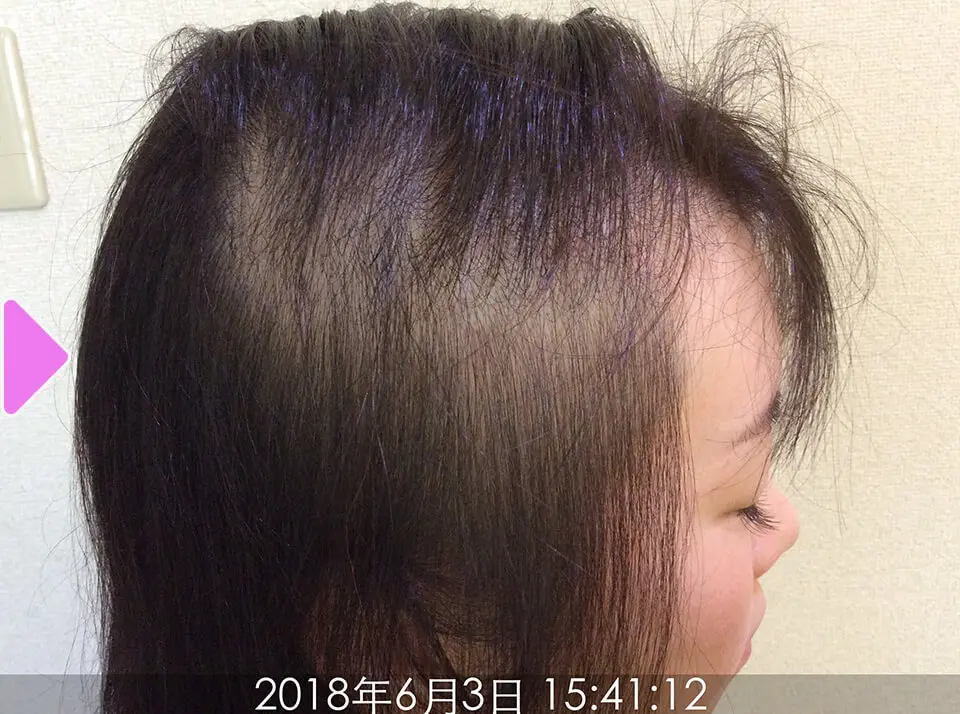 7ヵ月後