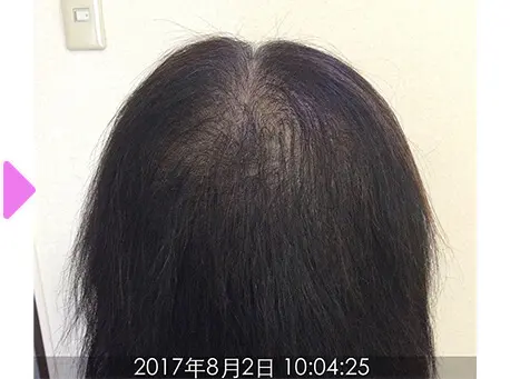 7ヵ月後（後部）