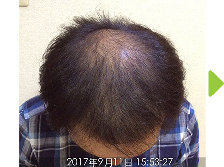 施術前