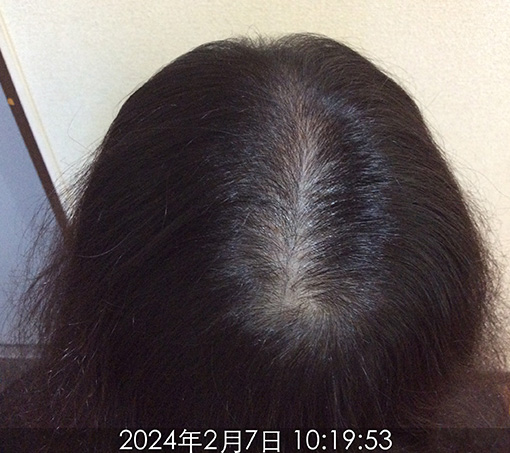 施術前-3