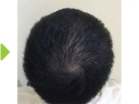50日後