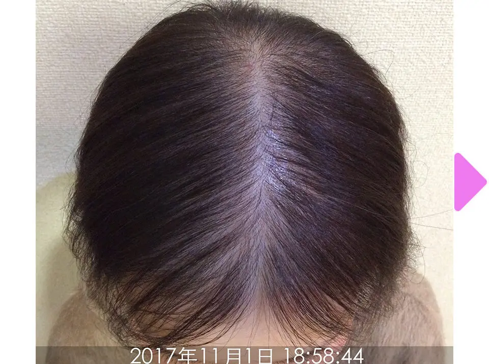 施術前