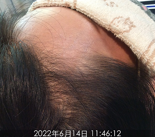 施術後2