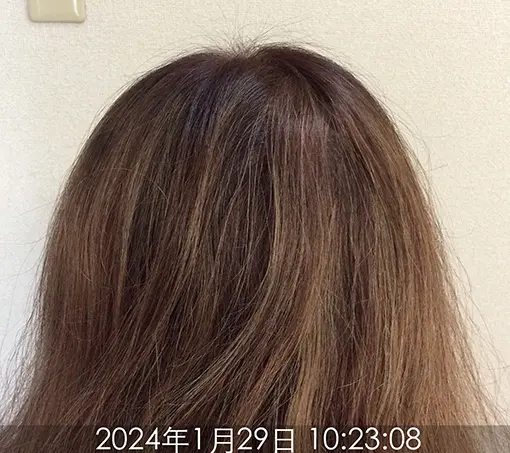 施術後②