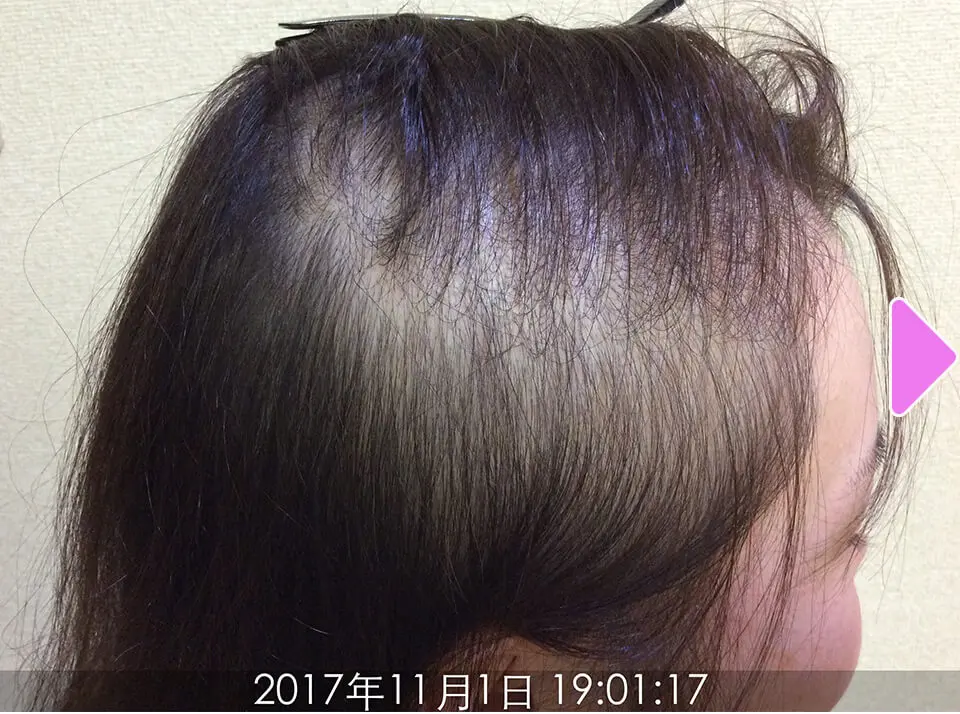 施術前