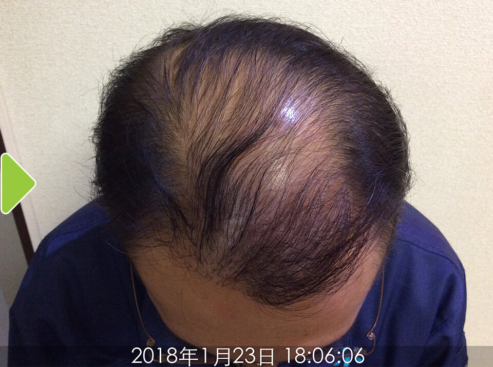 4ヵ月後-1