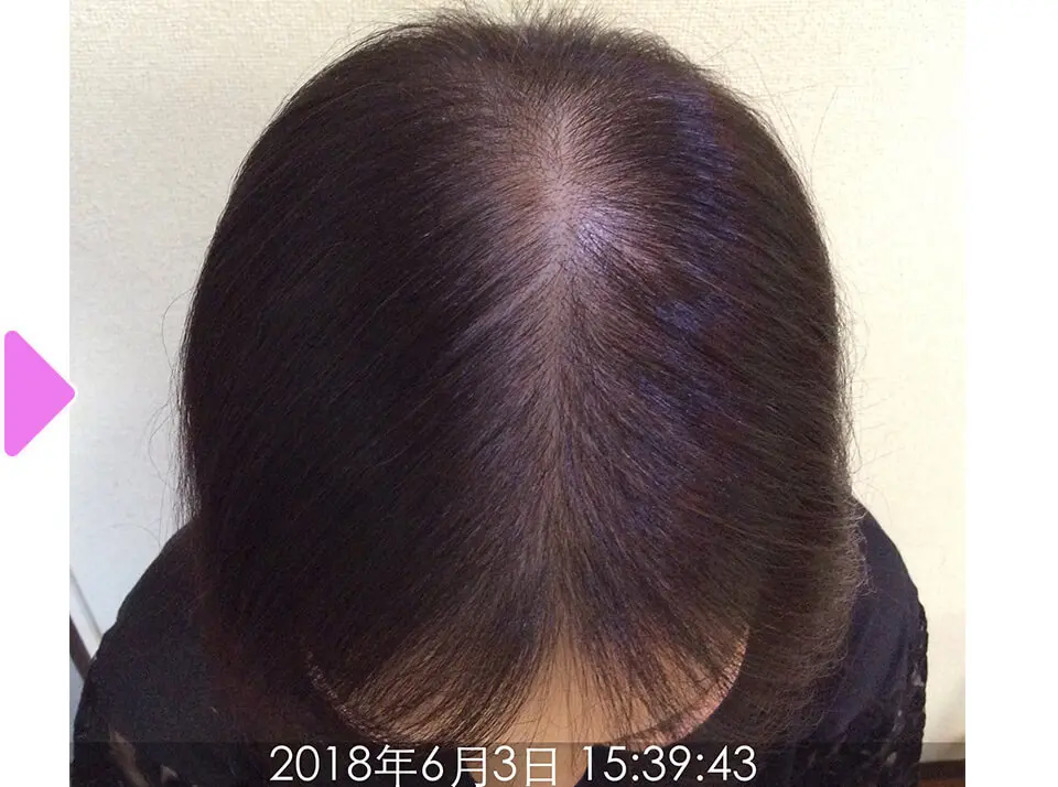 7ヵ月後