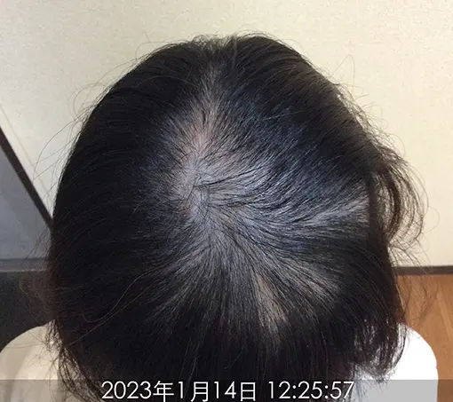 施術前-3