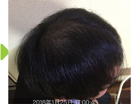 4ヵ月後-2