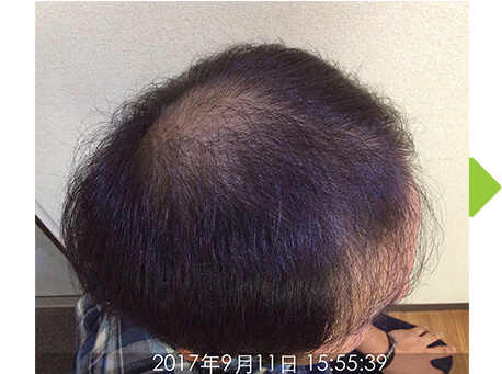 施術前