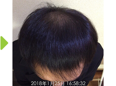 4ヵ月後-1