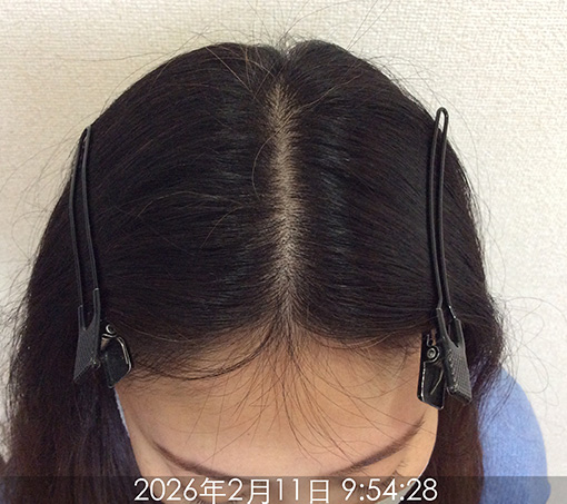 施術前1