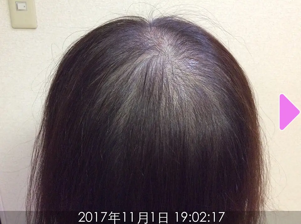 施術前