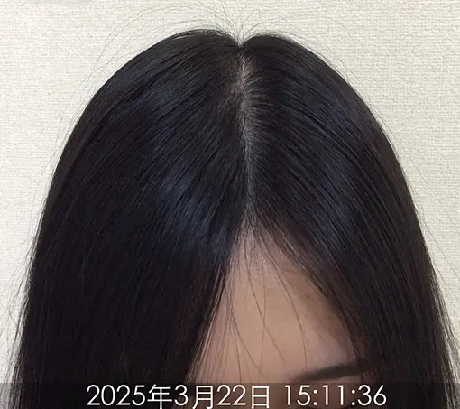 施術後-2