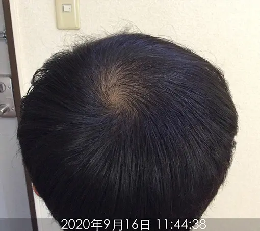 施術後