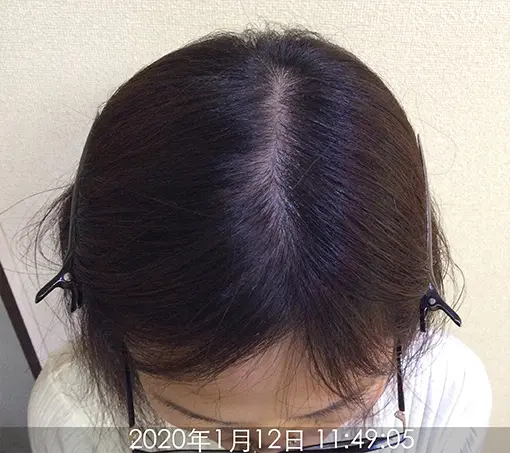 施術前