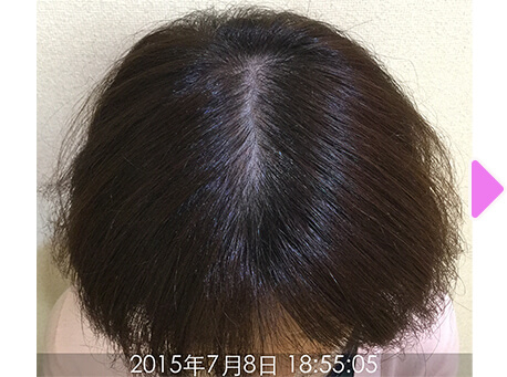 施術前