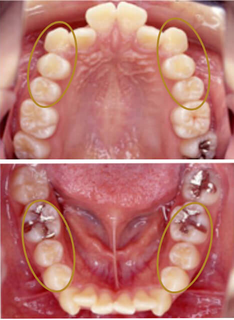 適応不可能な状態のサンプル写真2