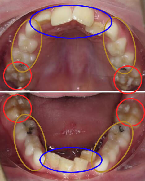 適応可能な状態のサンプル写真2