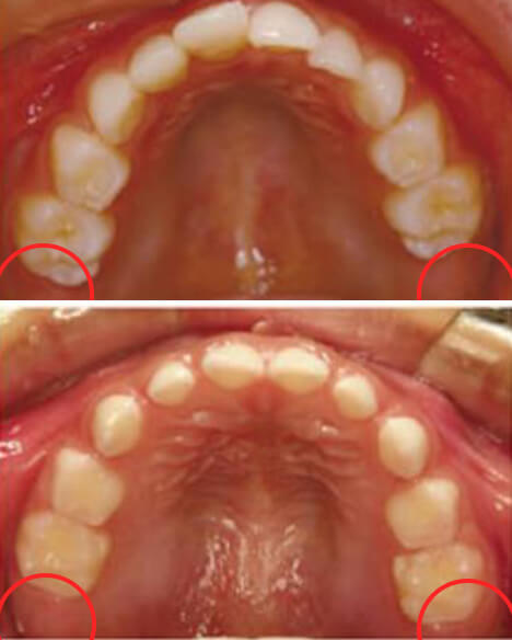 適応不可能な状態のサンプル写真1