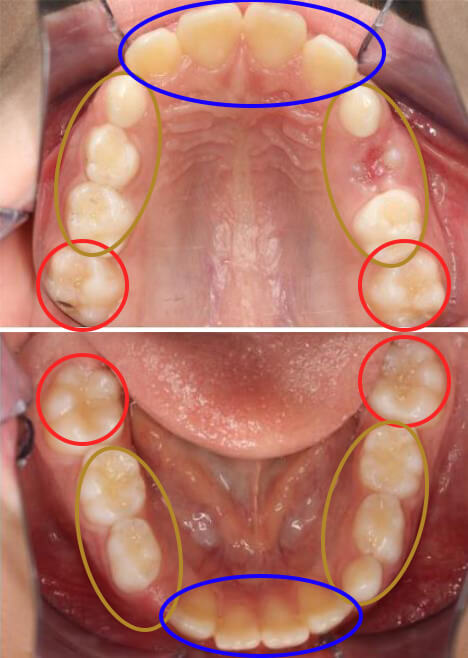適応可能な状態のサンプル写真1