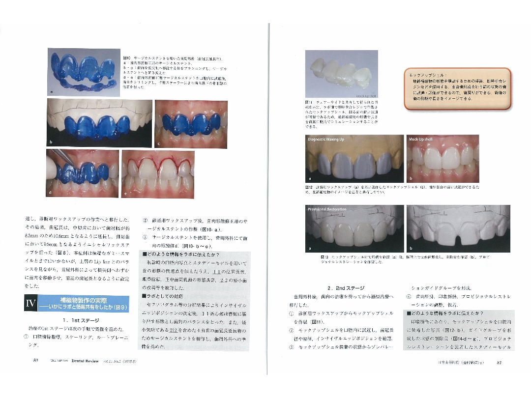 『日本歯科評論（THE NIPPON　Dental Review）』2015年5月号／別刷／ページ6・7