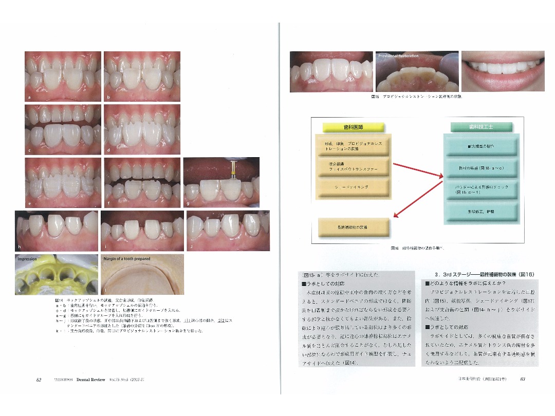 『日本歯科評論（THE NIPPON　Dental Review）』2015年5月号／別刷／ページ8・9