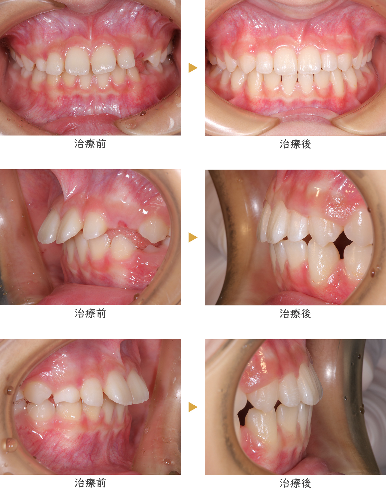 CASE1