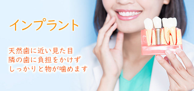 インプラント