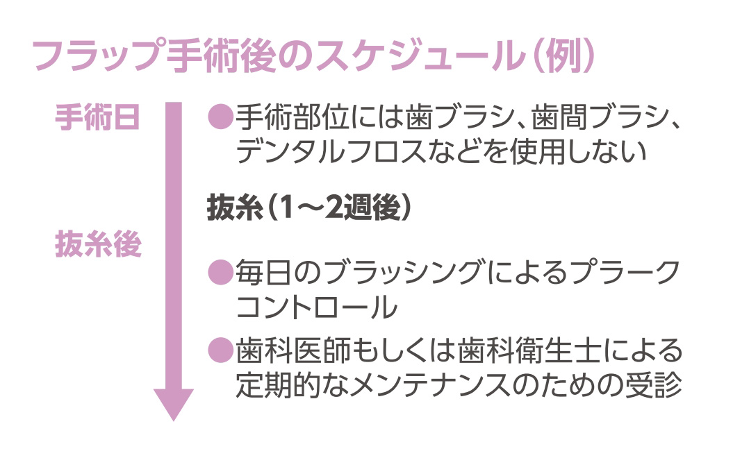 リグロス（歯周組織再生療法） - 医療法人 末永歯科医院 - 福島市の歯医者