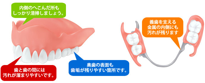 義歯（入れ歯）の清掃 - 医療法人 末永歯科医院 - 福島市の歯医者