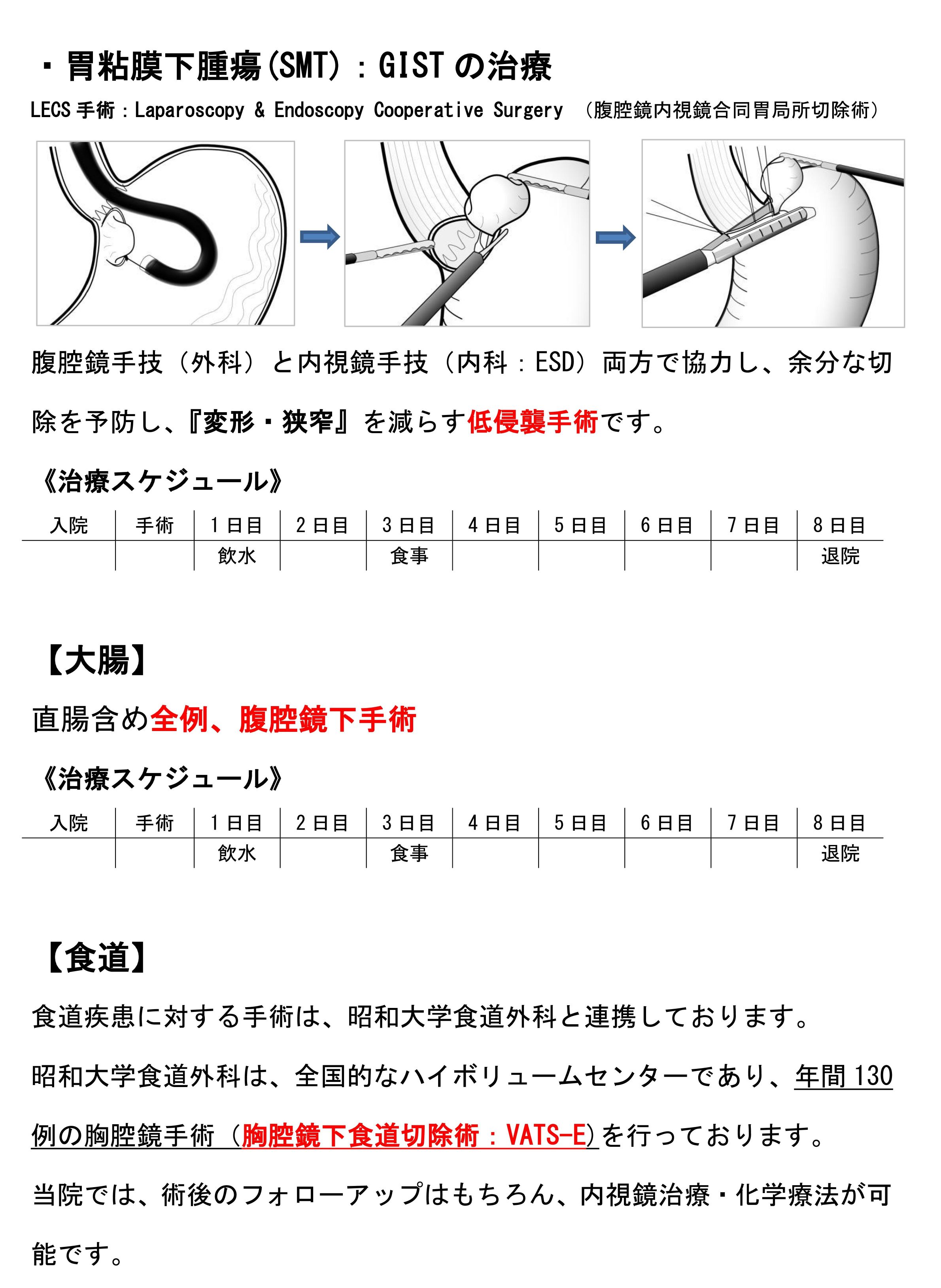 胃粘膜下腫瘍(SMT)：GISTの治療