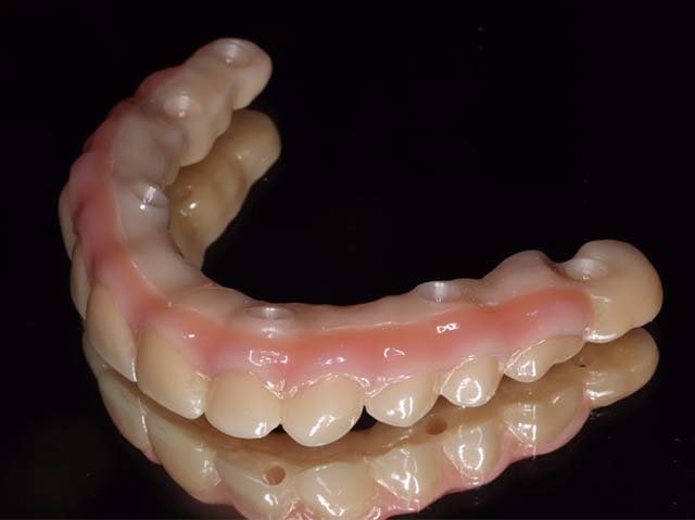 スペシャルブリッジ