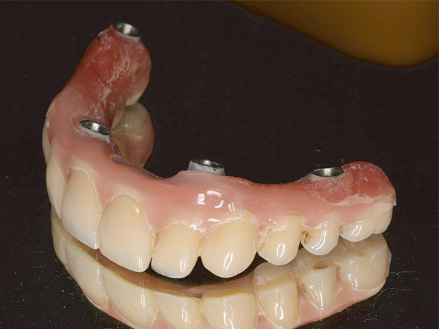 TWA ブリッジ(エントリーブリッジ)