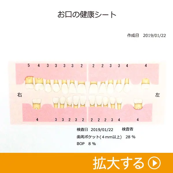 歯周病検査