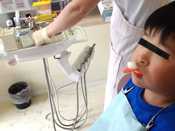 小児歯科治療