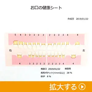 歯周基本検査