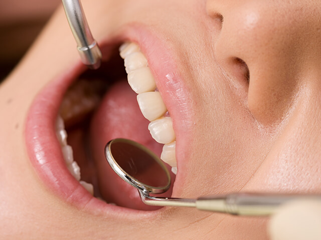 STEP5 メンテナンス