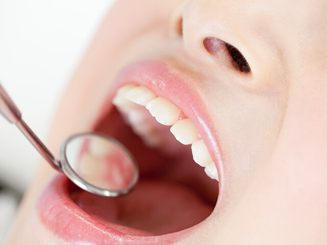 STEP1 口腔内診断