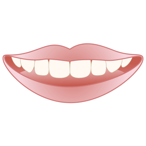 ホワイトニング完了