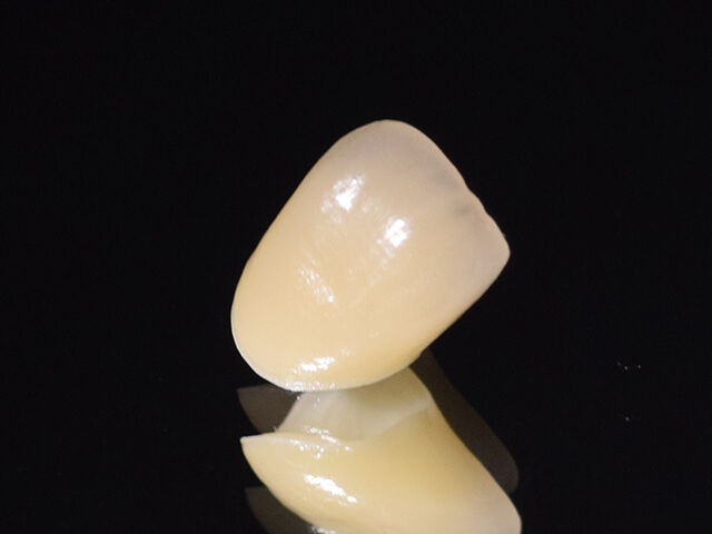 ジルコニアは奥歯のかぶせものに最適な素材です