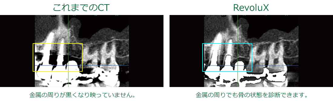 15ステップで使いこなそう歯科用CTの完全活用 15ステップで使いこなそう歯科用CTの完全活用画像診断体験