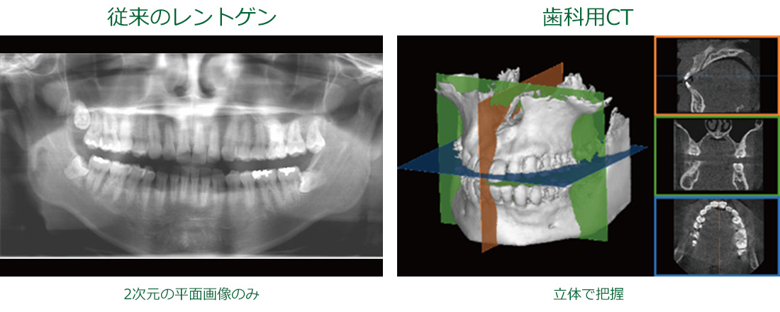 15ステップで使いこなそう歯科用CTの完全活用 歯科用CT - ながや歯科医院【公式】仙台市宮城野区の歯医者