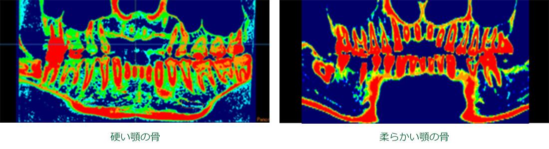 歯科用ct ながや歯科医院 公式 仙台市宮城野区の歯医者