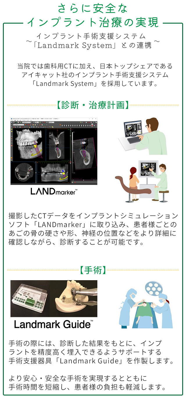 歯科用CT - ながや歯科医院【公式】仙台市宮城野区の歯医者