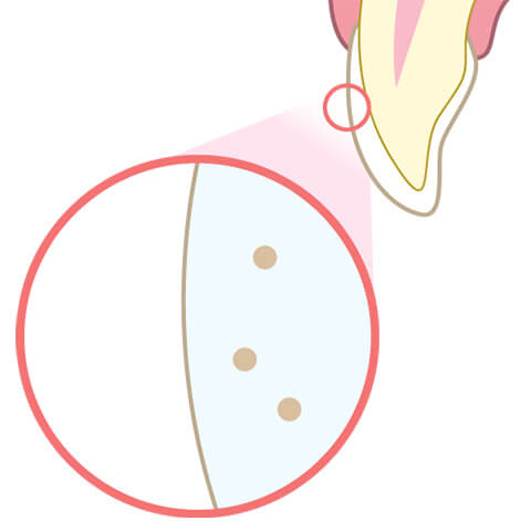 歯が白く美しく変身!